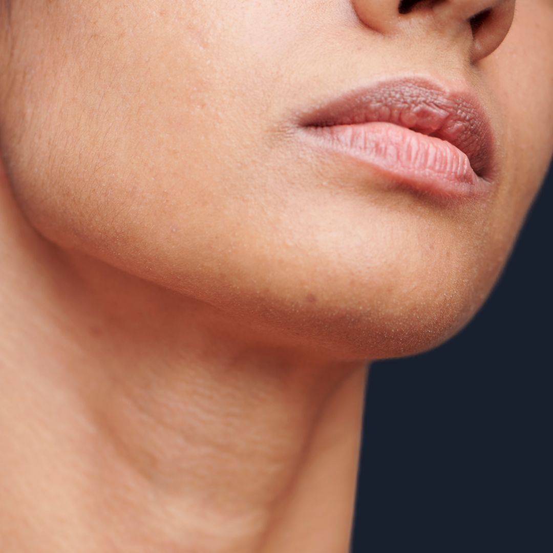 Don’t Stop at the Jawline: Skincare for Your Neck, Décolletage & Hands