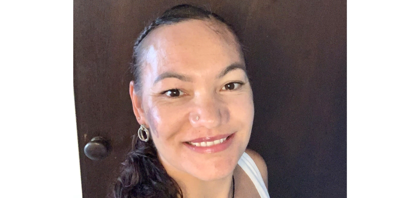 Skin Confidence Journey Story: Waihoroi, Forties