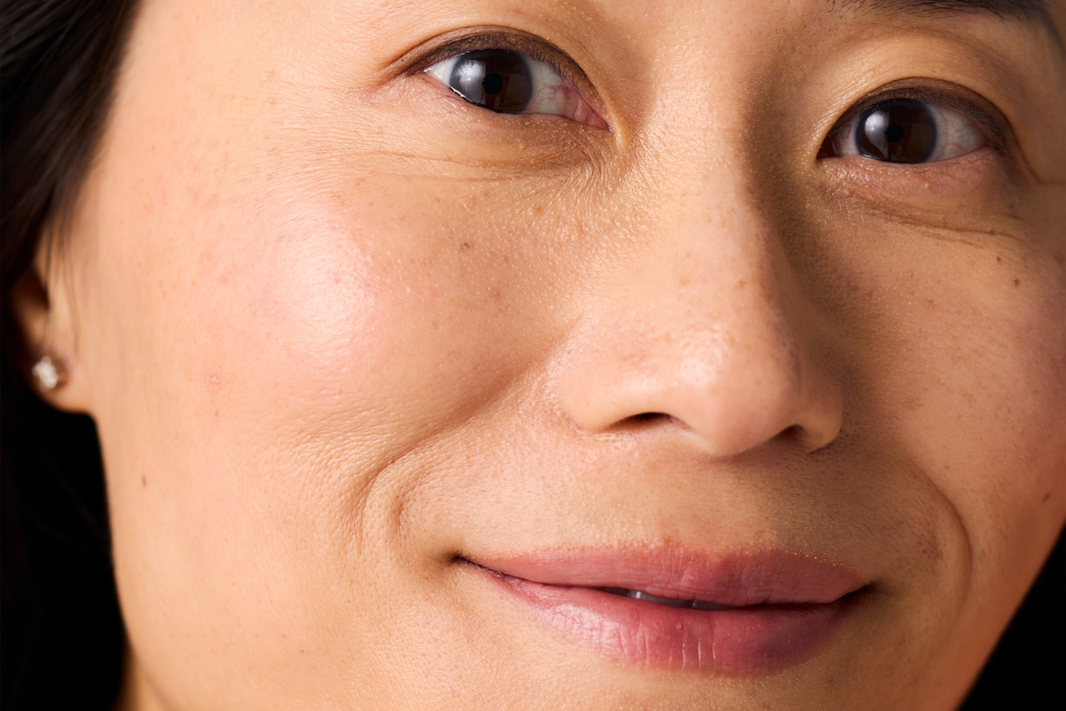 What a long-term skin plan really looks like