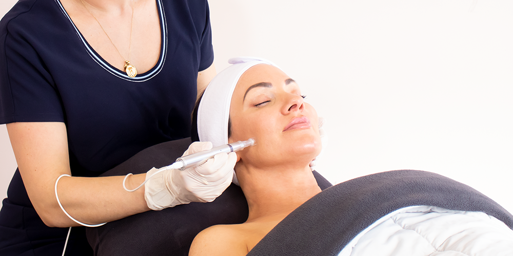 Microneedling for acne scars explained