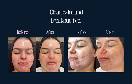 My Skin Story: Sophia