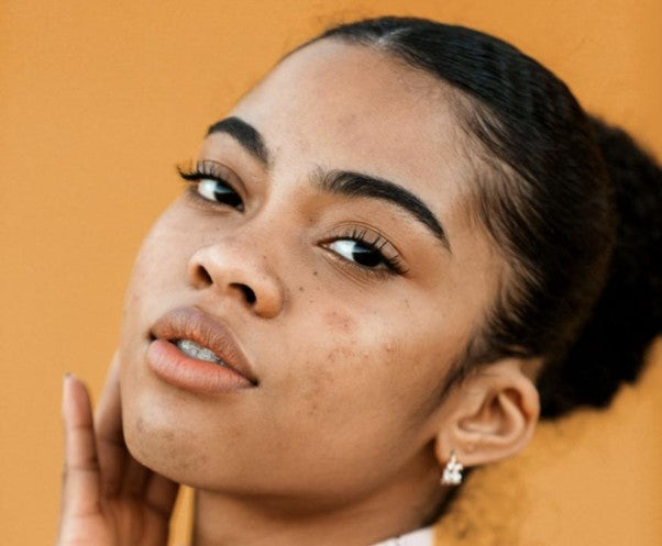 Retinol for acne; how retinol can help clear your skin
