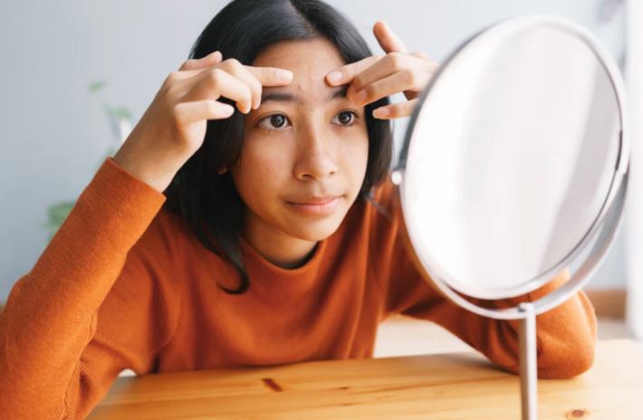 Acne Myths Debunked: What Really Works for Clear Skin