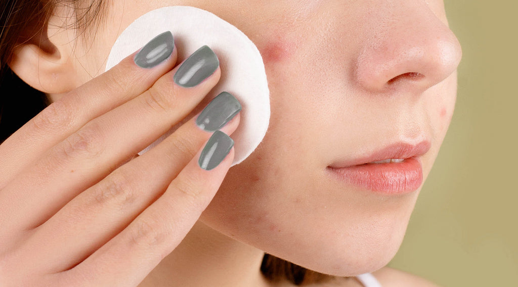 The Ultimate Guide to Treating Acne-Prone Skin