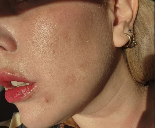 Robecca Leyden: Why I Love Photo Rejuvenation