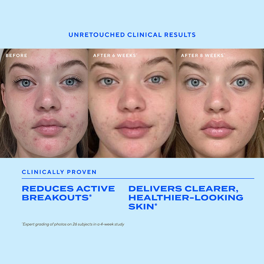 Murad Biome-Balancing Clear & Prevent Blemish Treatment Serum