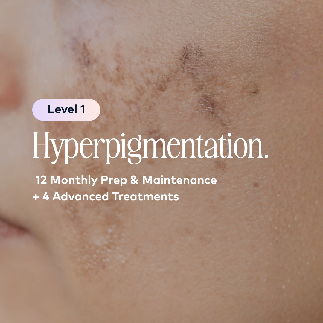 Hyper Pigmentation Level 1