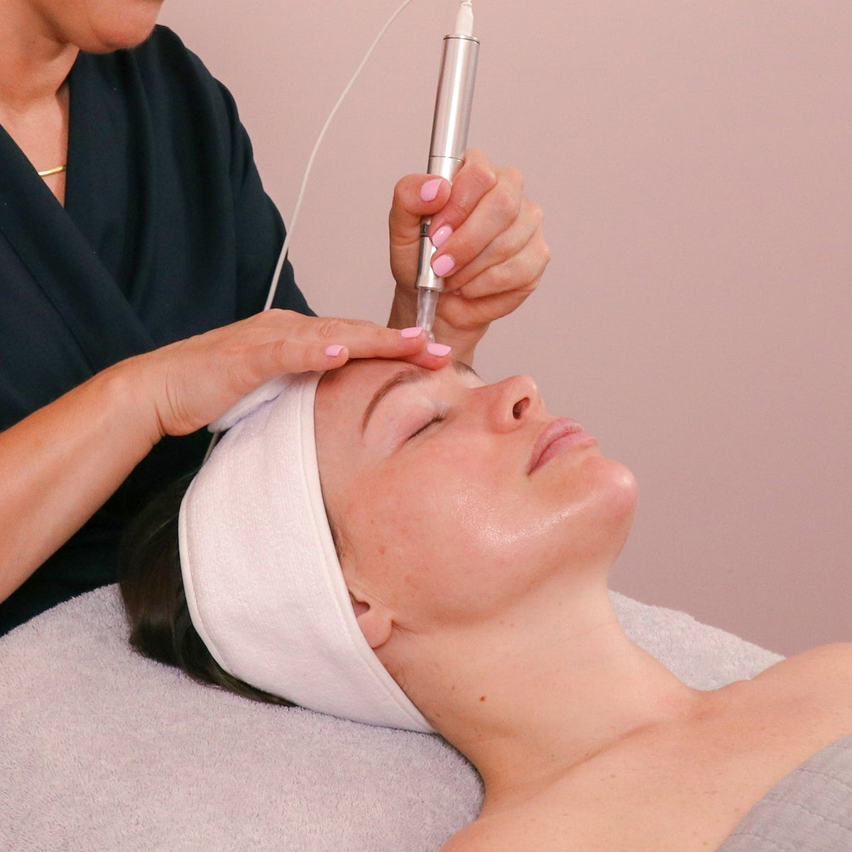 Microneedling treatment at Caci