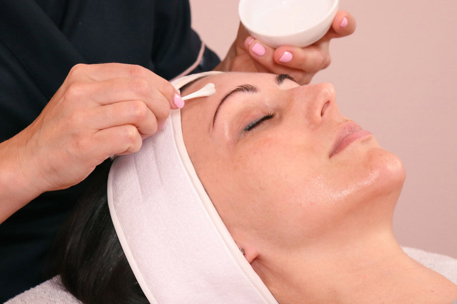 Rapid Resurfacing Peel treatment at Caci