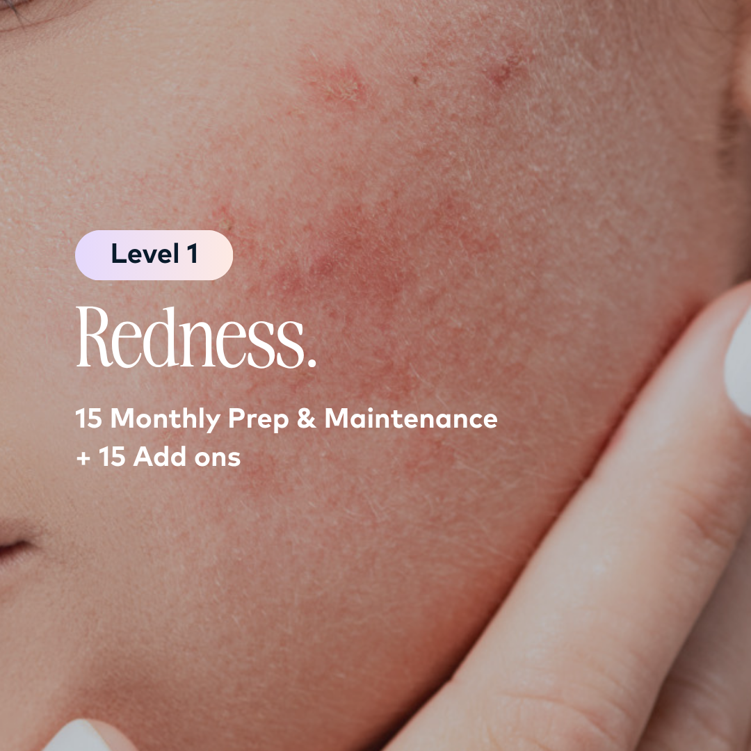 Redness Level 1