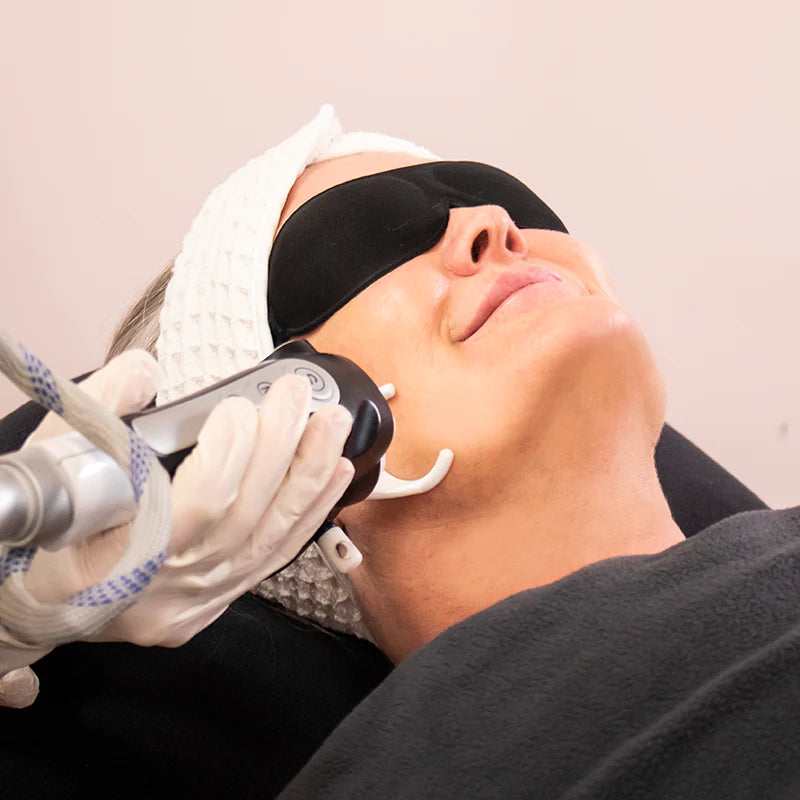 Fractional Co2 Laser