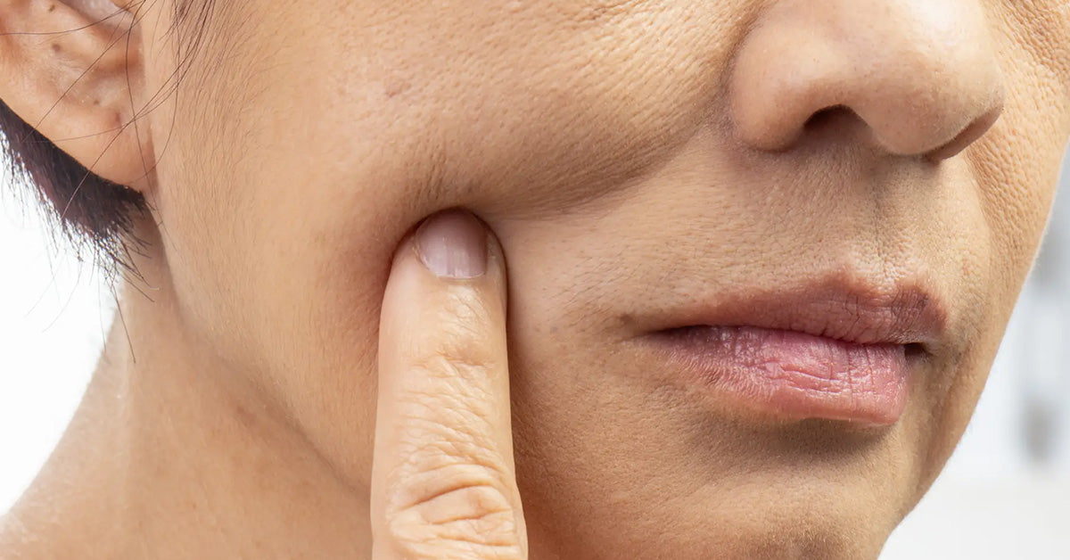 Cara Hilangkan Kedut Muka — Rawatan Tanpa & Dengan Prosedur 1 Cara Hilangkan Kedut Muka — Rawatan Tanpa & Dengan Prosedur